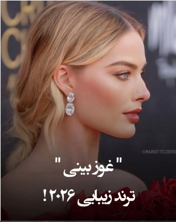 زیبایی غوز بینی ۲۰۲۶