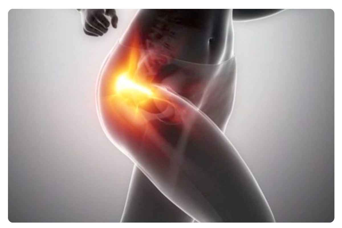 پوبالژیا بیماری ورزشکاران