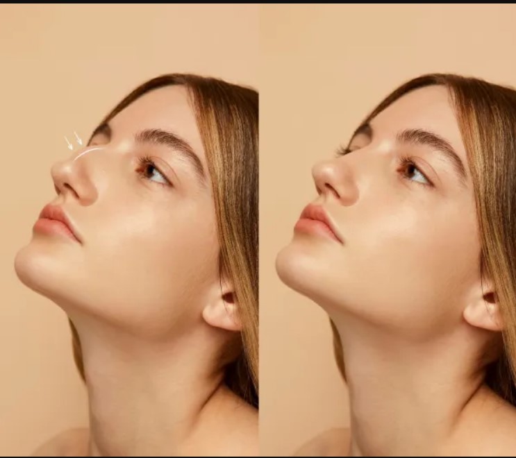 نکات زیبایی بینی ۲۰۲۶
